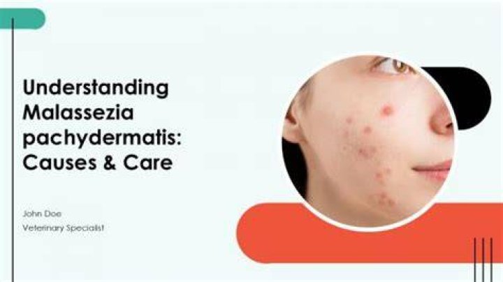 What causes Malassezia pachydermatis?