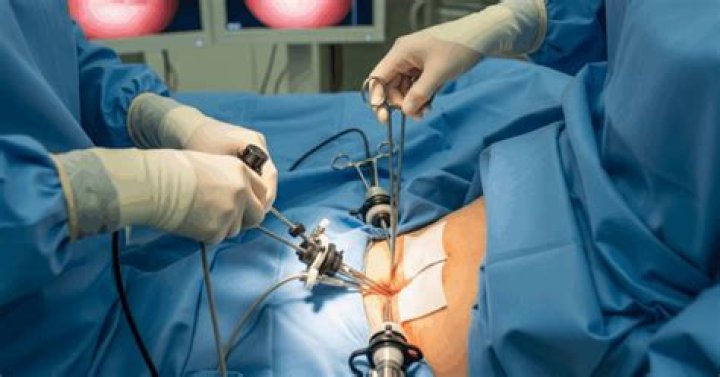 Where are the incisions for laparoscopic hernia surgery?