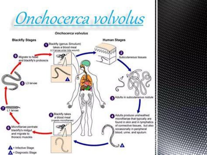 Where is Onchocerca found?